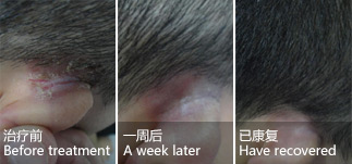 Male, ear psoriasis for 2 years